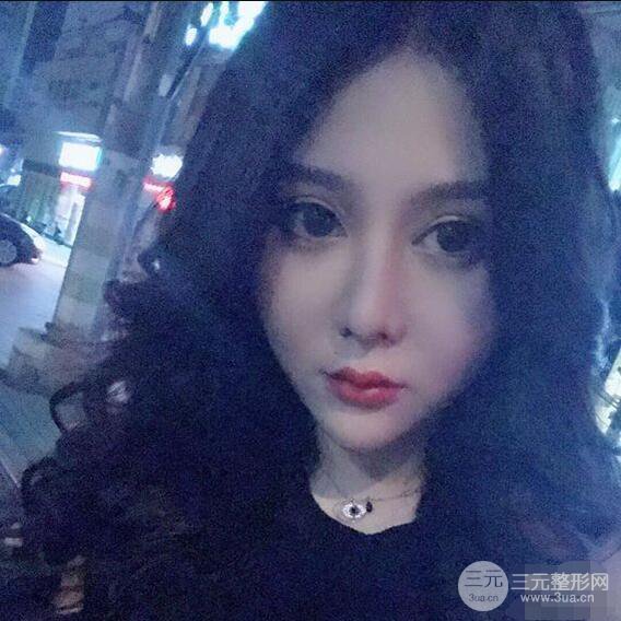 昆明吴氏嘉美李明硅胶隆鼻前后对比图恢复心情小札
