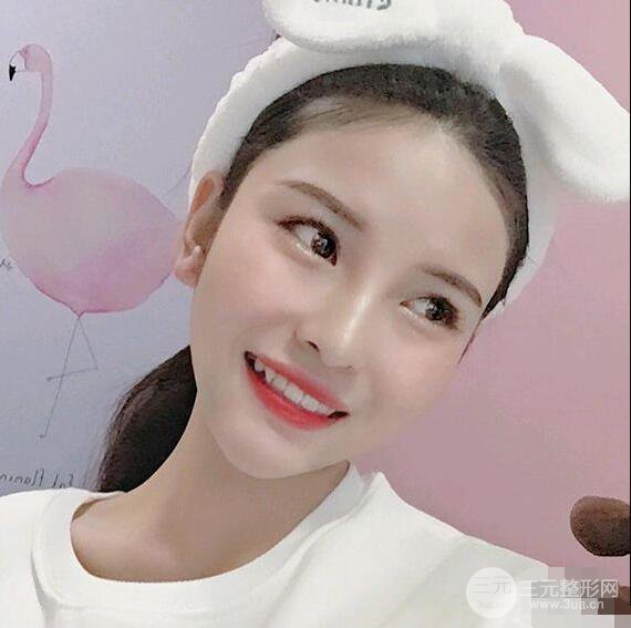 成都华西医院整形美容科卿勇隆鼻整形前后对比图恢复心情小札