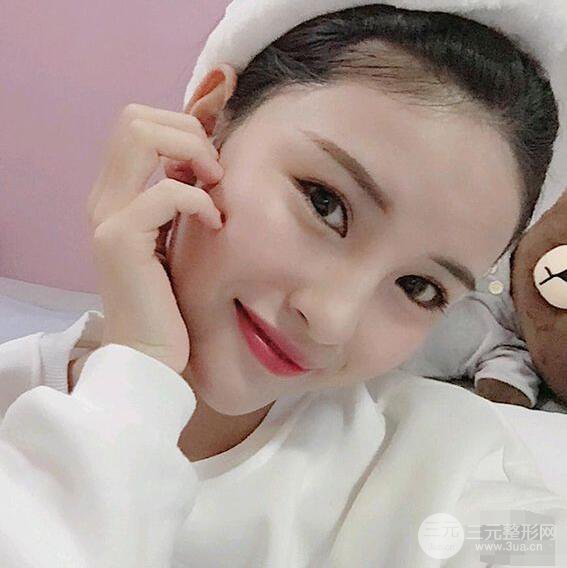 成都华西医院整形美容科卿勇隆鼻整形前后对比图恢复心情小札