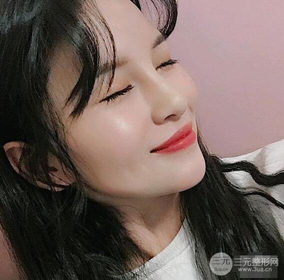 成都华西医院整形美容科卿勇隆鼻整形前后对比图恢复心情小札