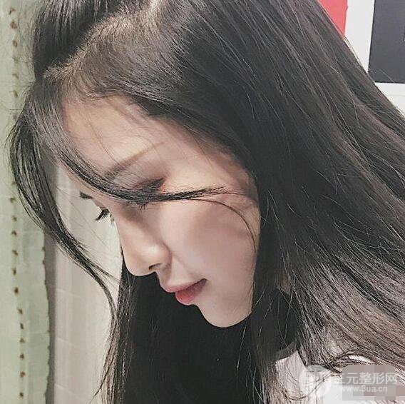 成都华西医院整形美容科卿勇隆鼻整形前后对比图恢复心情小札