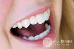 镍铬合金烤瓷牙有哪些危害了