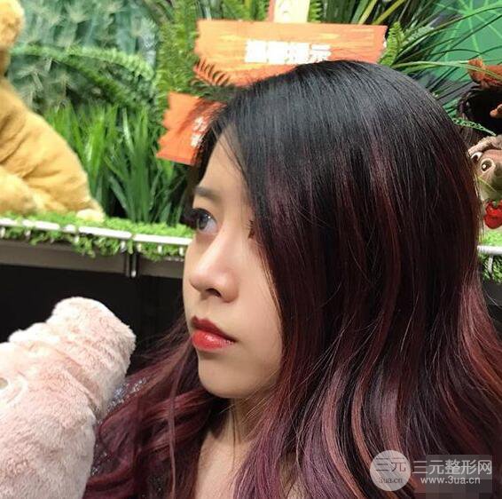 重庆华美何春涛硅胶隆鼻前后对比图 内附恢复心情小札