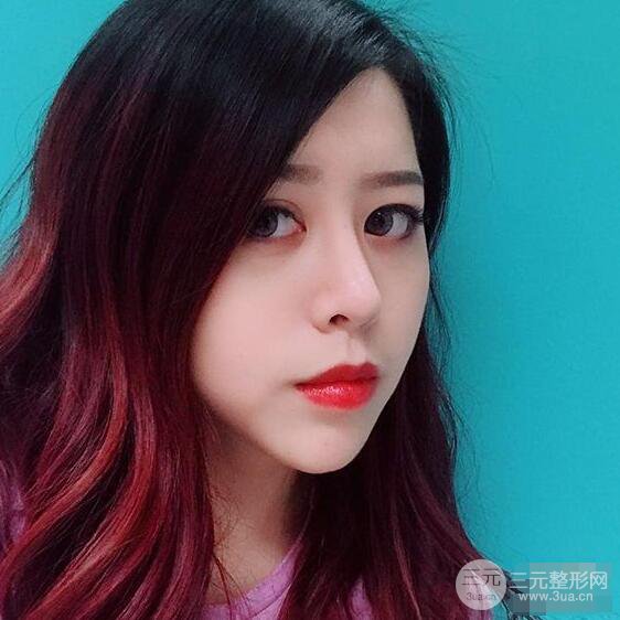 重庆华美何春涛硅胶隆鼻前后对比图 内附恢复心情小札