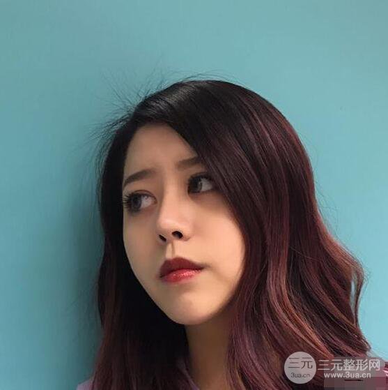 重庆华美何春涛硅胶隆鼻前后对比图 内附恢复心情小札