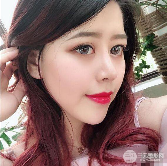 重庆华美何春涛硅胶隆鼻前后对比图 内附恢复心情小札