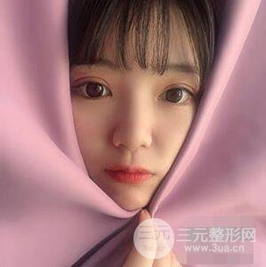 贵阳美贝尔黄在弘全切双眼皮前后对比图|**解决大小眼