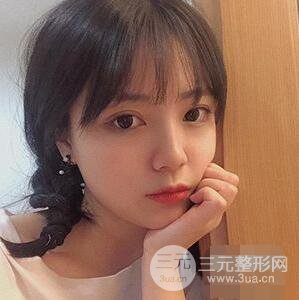 贵阳美贝尔黄在弘全切双眼皮前后对比图|**解决大小眼