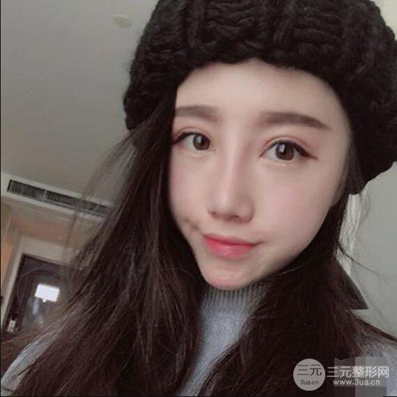 北京联合丽格吴焱秋耳软骨隆鼻前后对比图|塌鼻子的救星