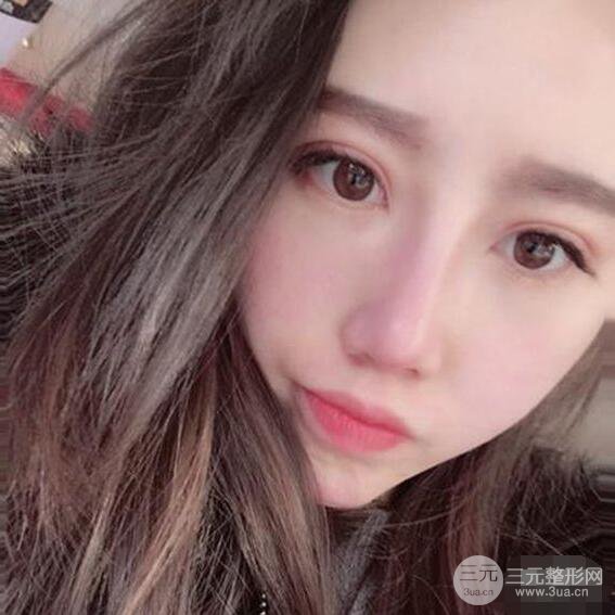 北京联合丽格吴焱秋耳软骨隆鼻前后对比图|塌鼻子的救星