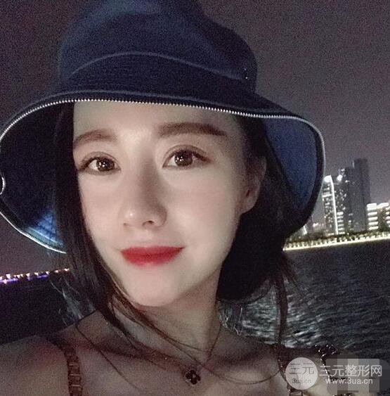 北京联合丽格吴焱秋耳软骨隆鼻前后对比图|塌鼻子的救星