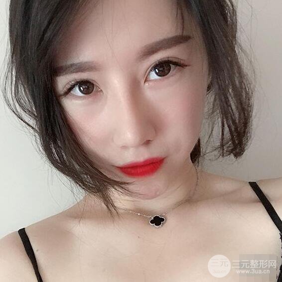 北京联合丽格吴焱秋耳软骨隆鼻前后对比图|塌鼻子的救星