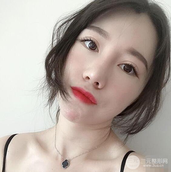 北京联合丽格吴焱秋耳软骨隆鼻前后对比图|塌鼻子的救星