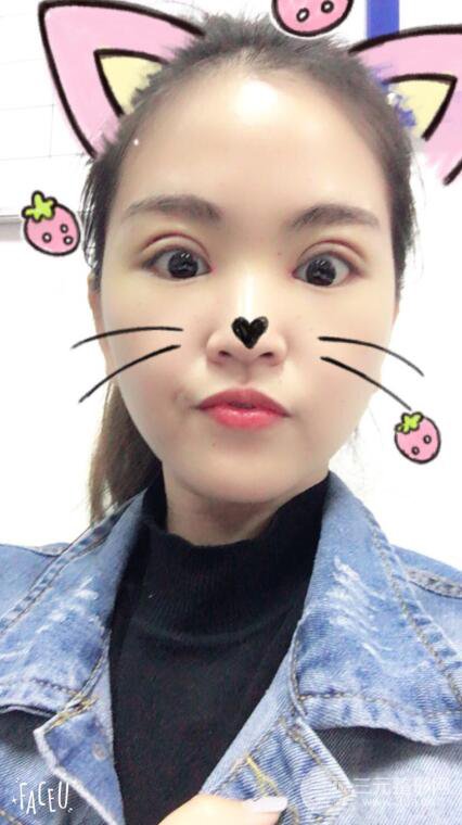 沈阳百嘉丽叶微微切开双眼皮前后对比图恢复心情小札