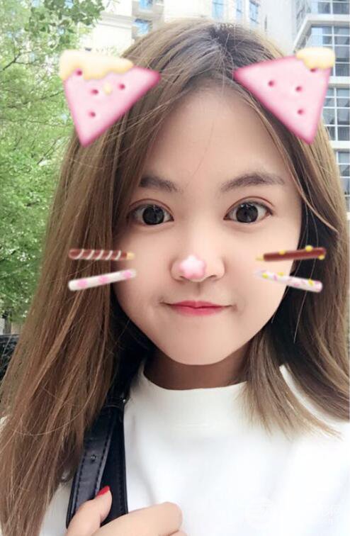 沈阳百嘉丽叶微微切开双眼皮前后对比图恢复心情小札