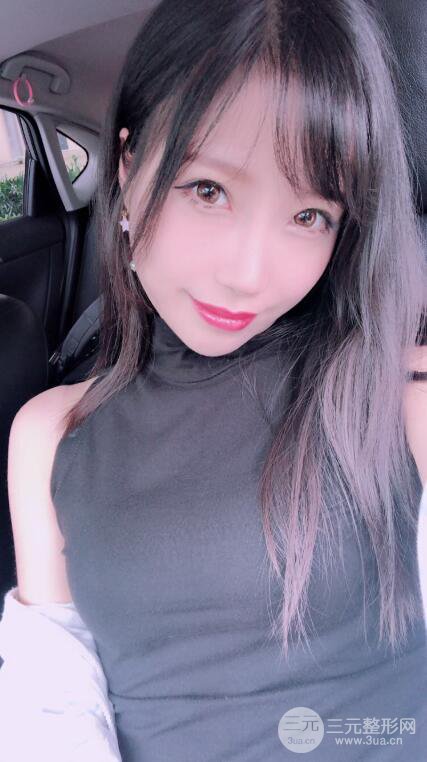 昆明华美美莱杨继红肋软骨隆鼻前后对比图恢复手札