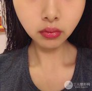 韩式漂唇多少钱？漂唇后多久能恢复正常？