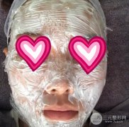 黄金微针成好吗？黄金微针有没有副作用？
