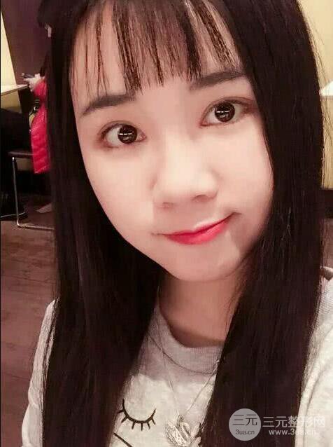 青医附院美容科任纪祯塌鼻子隆鼻前后对比图恢复心情小札