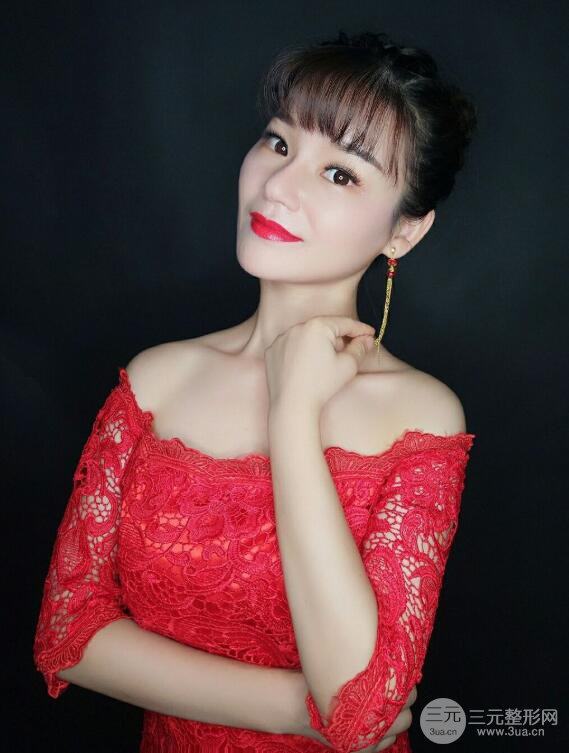 厦门修志夫隆鼻整形前后对比图真人案例恢复小札