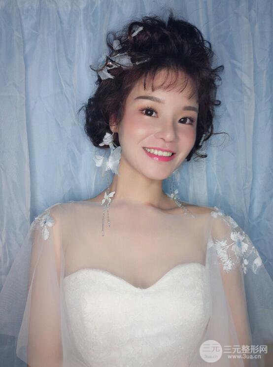 厦门修志夫隆鼻整形前后对比图真人案例恢复小札