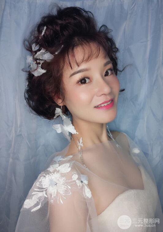 厦门修志夫隆鼻整形前后对比图真人案例恢复小札