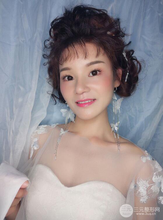 厦门修志夫隆鼻整形前后对比图真人案例恢复小札