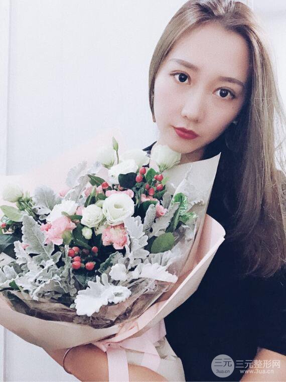 哈医大二院整形科肖志波全切双眼皮前后对比图 真实恢复经历日记