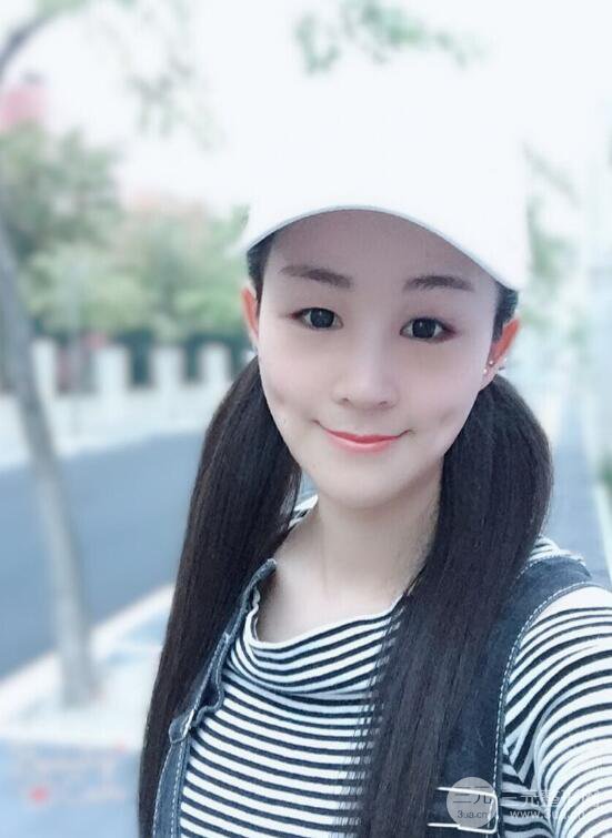 杭州华山连天美高俊明假体隆鼻术前术后对比图 两个月恢复心情