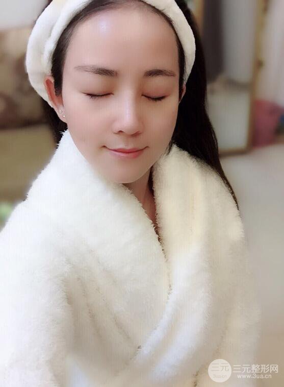 杭州华山连天美高俊明假体隆鼻术前术后对比图 两个月恢复心情