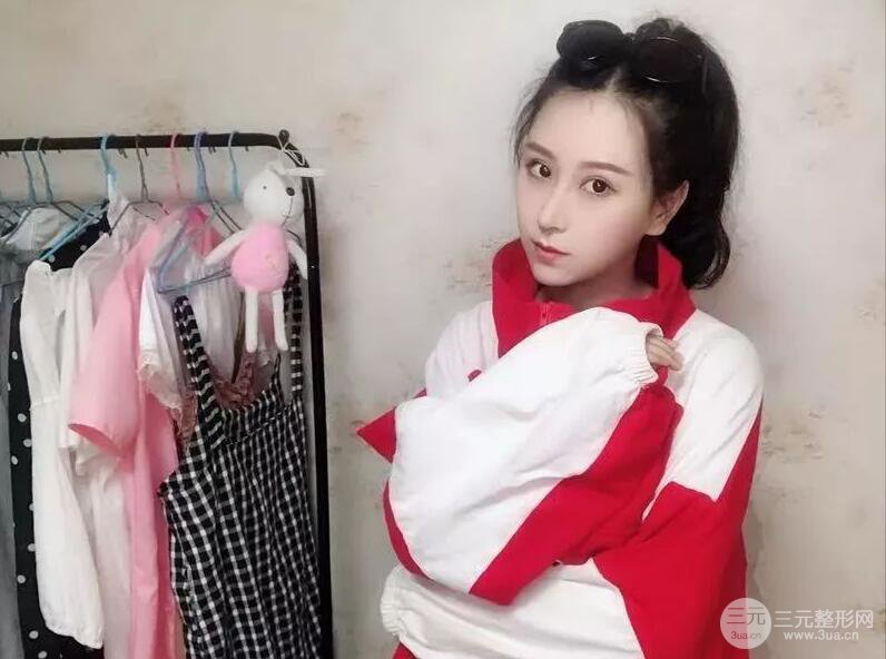 北京艺星仇侃敏微创肋软骨隆鼻前后对比图 术后一个月的恢复状况