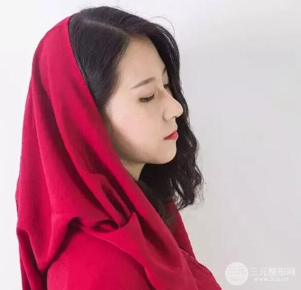 北京艺星仇侃敏微创肋软骨隆鼻前后对比图 术后一个月的恢复状况