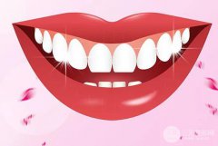 钛合金烤瓷牙好吗？