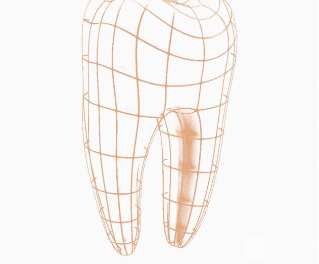 钛合金烤瓷牙好吗