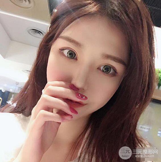 延吉金光善眼部整形失败修复前后对比图 三个月恢复自然