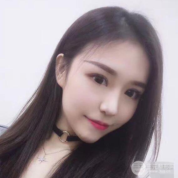 延吉金光善眼部整形失败修复前后对比图 三个月恢复自然