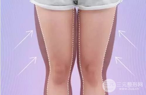 360度吸脂瘦大腿降低风险吗 吸脂果怎么样