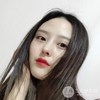 北京美莱赵峻贤隆鼻整形真实案例对比图恢复过程分享
