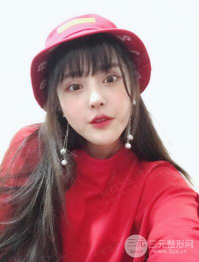 北京美莱赵峻贤隆鼻整形真实案例对比图恢复过程分享