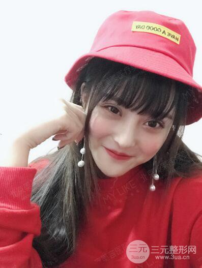 北京美莱赵峻贤隆鼻整形真实案例对比图恢复过程分享