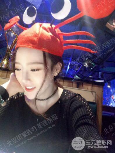 北京美莱赵峻贤隆鼻整形真实案例对比图恢复过程分享