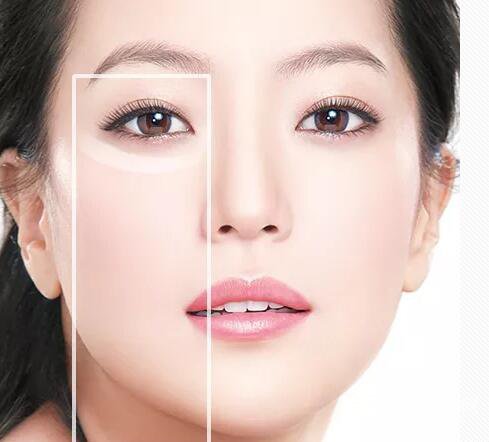 简单有去眼袋方法是什么?