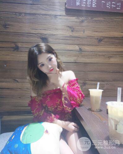 成都天使之翼张劲松切开双眼皮案例前后对比图心情小札