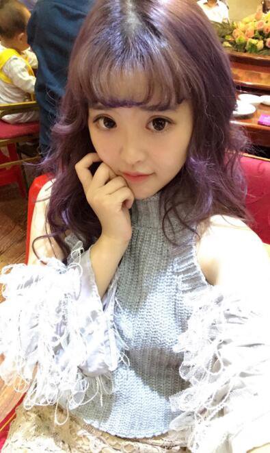 成都天使之翼张劲松切开双眼皮案例前后对比图心情小札