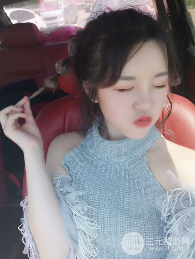 成都天使之翼张劲松切开双眼皮案例前后对比图心情小札