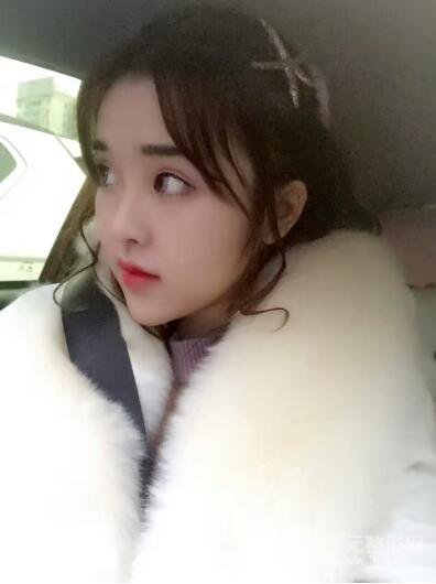 成都天使之翼张劲松切开双眼皮案例前后对比图心情小札