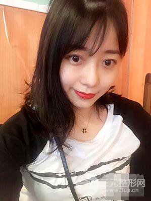 杭州华山连天美高俊明双眼皮案例前后对比图心情分享