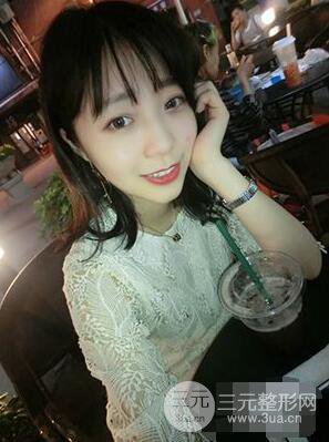 杭州华山连天美高俊明双眼皮案例前后对比图心情分享