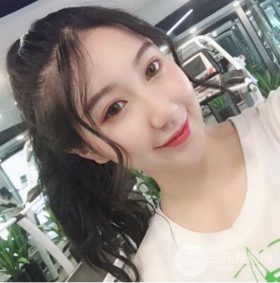 合肥壹加壹王大勇假体隆鼻果对比图 45天恢复心路历程