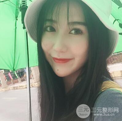 合肥壹加壹王大勇假体隆鼻果对比图 45天恢复心路历程